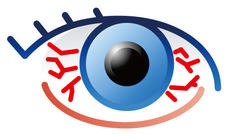 Vol.15 眼睛為什么會充血呢？