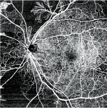 自動全景成像(可達(dá)12 x 12 mm) 自動全景成像(可達(dá)12 x 12 mm)