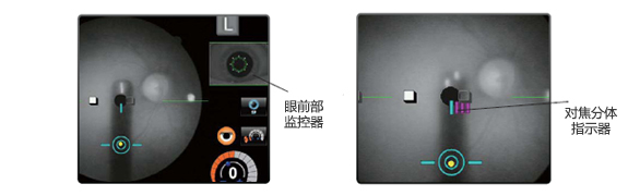 配備監控器和指示器